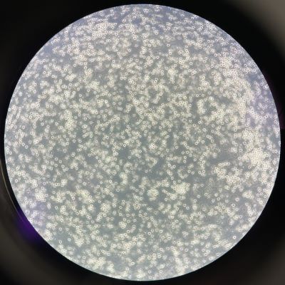 Lab Occurrences thumbnail